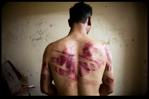 WEB Syrian Torture 001 &#8211; es