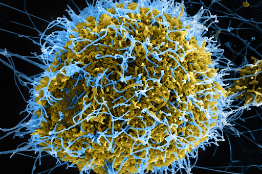 Ebola Virus 02 &#8211; es
