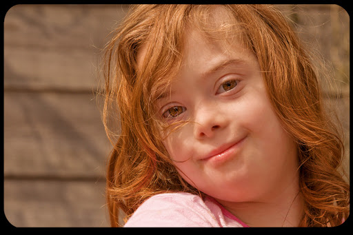 WEB Girl Downs Syndrome Andrea CC &#8211; es