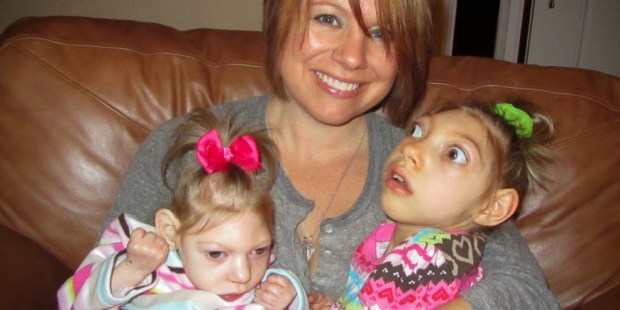 Habla una madre de dos niñas con microcefalia