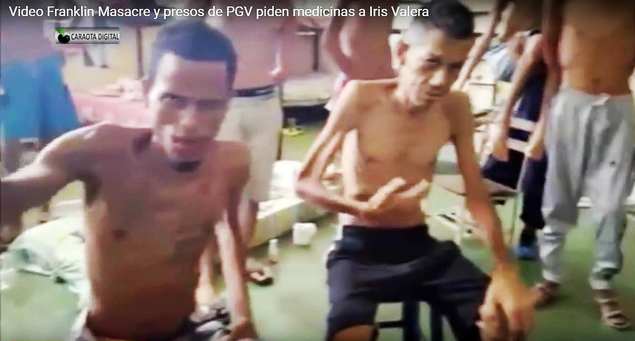 enfermos-de-tuberculosis-en-la-penitenciaria-general-de-venezuela-captura-youtbe-3