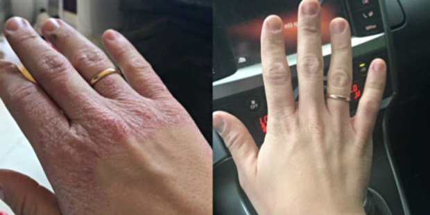 hands