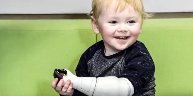 LITTLE BOY WITH 3D PRINTED ARM