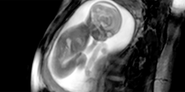 ULTRASOUND