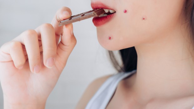 acne problem