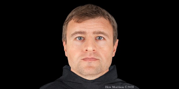 FORENSIC FACIAL RECONSTRUCTION