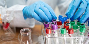 Vacunas contra el coronavirus de Moderna y Pfizer, sin células fetales