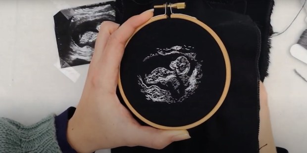 EMBROIDERED ULTRASOUND