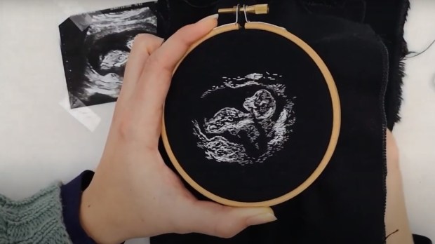 EMBROIDERED ULTRASOUND