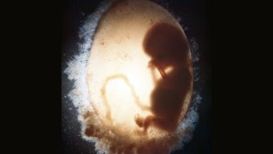 web-fetus-embryo-11-weeks-joo-lee-getty