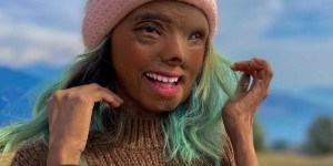 Thumbnail for read also