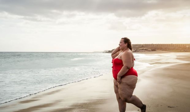 mujer con obesidad