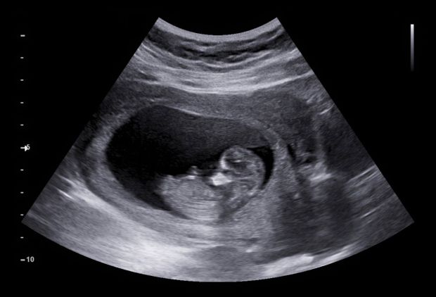 baby in the womb