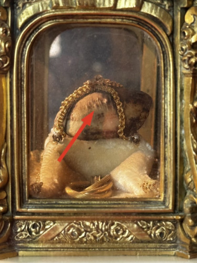 rotule-relique-sainte-therese-de-lisieux